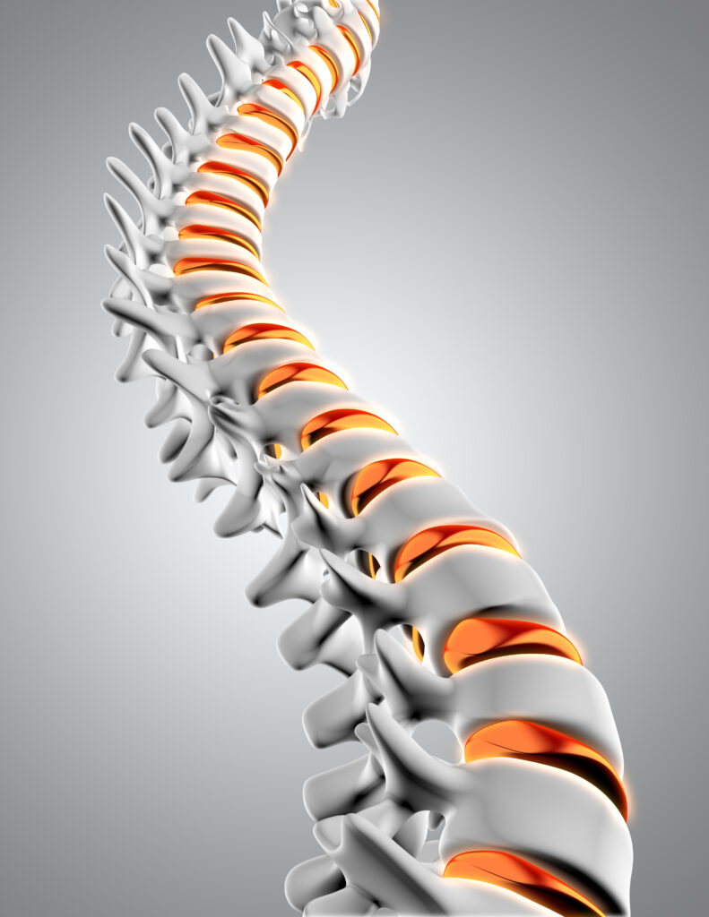 Richtige Ernährung bei chronischer Osteoporose