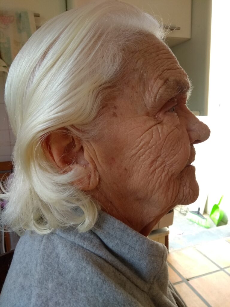 Natürliche Lösungen zur Pflege und Ursachen von Falten